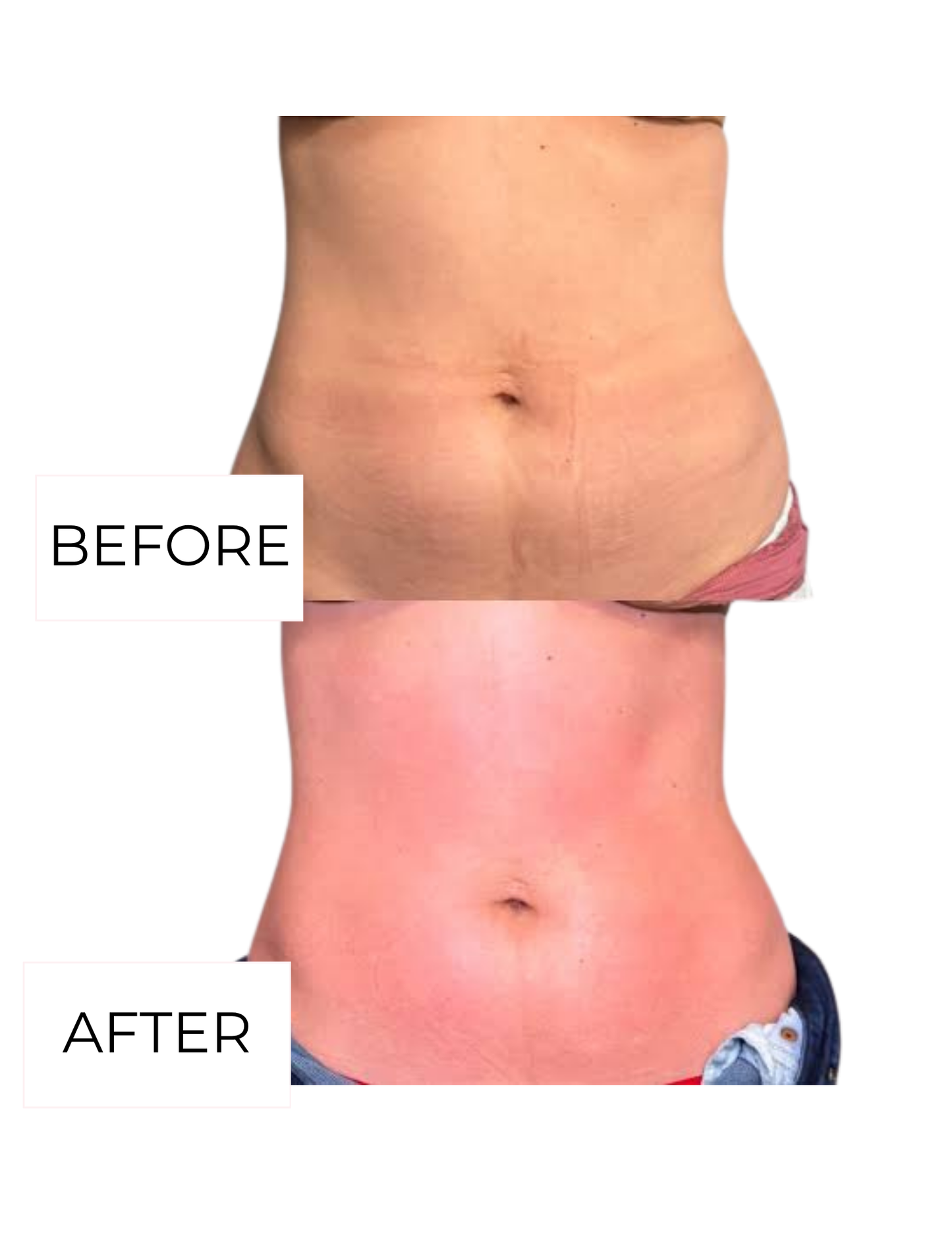 The Summer Shape-Up Package (Save $100 + Free Vibration Plate/LED)